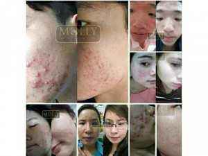 Sản phẩm làm đẹp cho chị em