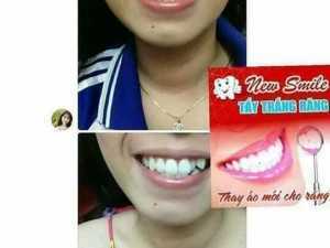 Bột tẩy trắng răng newsmile