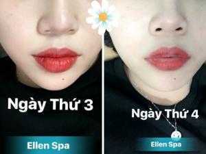 Phun môi châu Âu - Phun môi siêu vi chạm theo kỹ thuật Châu Âu ngày thứ hai từ dịch vụ phun môi tại Hóc Môn của Ellen Spa