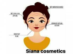 Serum collagen siana