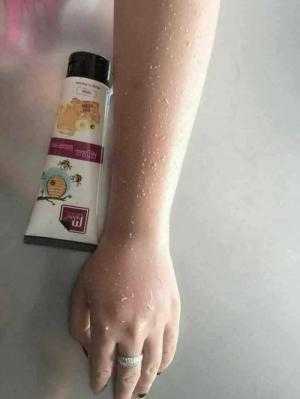 Tẩy Tế Bào chết Mwhite