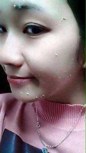Tẩy Tế Bào chết Mwhite