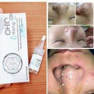 Tinh Chất Ủ mụn Ohio Hangul chính hãng giá tốt.