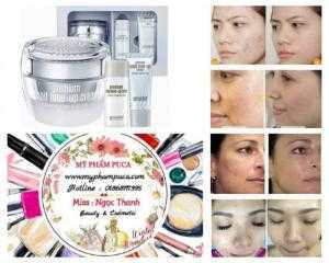 Kem Goodal Premium Snail Tone Up Cream có chiết xuất từ ốc sên và tinh chất nhân sâm trắng có tác dụng dưỡng trắng, sáng da, cải thiện tông màu da, cho bạn làn da trắng hồng rạng rỡ.