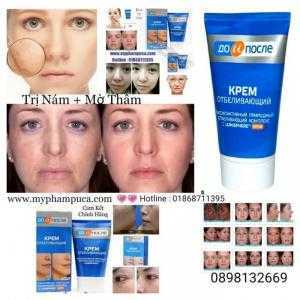 Kem Trị Nám _ Trị Nám Kpem Chính Hãng Chai Lớn 100mil