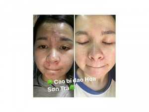 Cao Bí Đao Lyly Hoa Sơn Trà