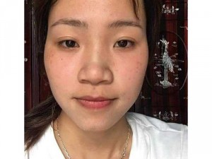 Tái tạo da feather life