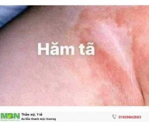 Da liễu thanh mộc hương