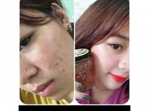 Mặt nạ ngủ yến tươi. trị Mụn. Nám. Tàn Nhan