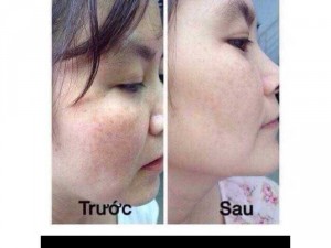Mặt nạ ngủ yến tươi. trị Mụn. Nám. Tàn Nhan
