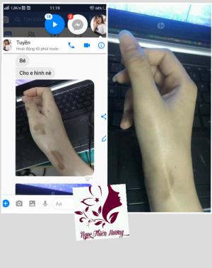 Tinh dầu trị thâm Ngọc Thiên Hương
