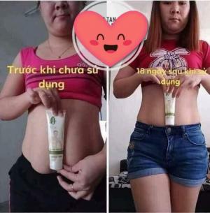 Gel tan mỡ quế Olic tặng miếng dán tan mỡ