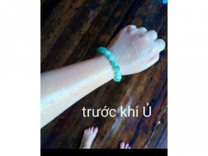Ủ trắng lúa mạch