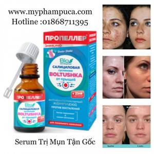 #kemtrimunnga #trimun #immuno #muntrungca #kemtrimun #www.myphampuca.com
#serumtrimun #kemtrimunphotoshop #trimunchonam #trimunboltushkapropellerimmuno #photoshop #kemtrimunsosturboactive #suaruamattrimun #kemdaunguaguerisson9complex #vuatrinam #kemocsengoodal #snailwhite #www.myphampuca.com #kemtrinamkpem