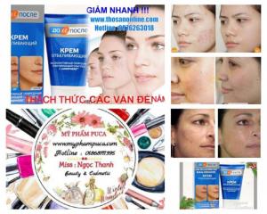 Kem Trị Nám Kpem - Kem Vua Nám Trị Nám Kpem