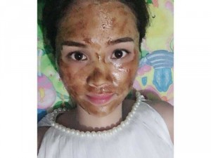 Phân phối, sỉ lẻ Mặt Nạ, thuốc trị mụn KIMTHIENHOA