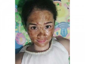 Phân phối, sỉ lẻ Mặt Nạ, thuốc trị mụn KIMTHIENHOA