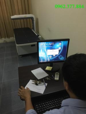 Máy đo mật độ xương tia X