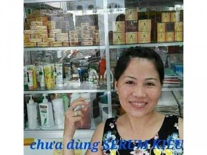 Serum thảo dược thiên nhiên 100%