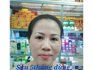 Serum thảo dược thiên nhiên 100%