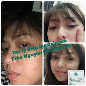 Diệp Lục Collagen