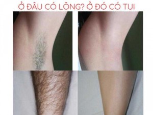 Kem Tẩy Lông chiết xuất Lô Hội LINH NHÂM
