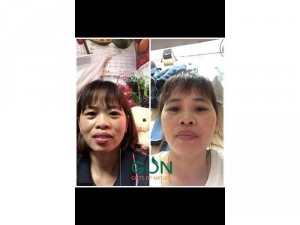Hãy cùng em chăm sóc da bằng Serum gon