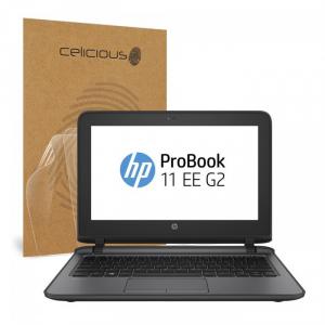 HP Probook 11 G2 -I3 6100U bán trả góp lãi suất 0%