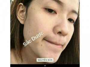 Sắc Dược Thảo Mộc Thiên Nhiên
