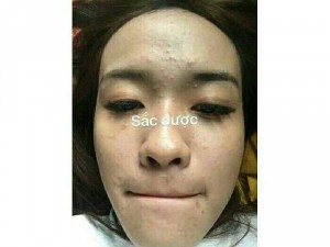 Sắc Dược Thảo Mộc Thiên Nhiên