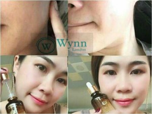 Mỹ phẩm cao cấp Hàn Quốc Wynn