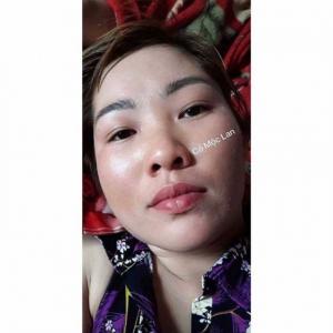 Serium Trị Mụn Nám Essence Peptide