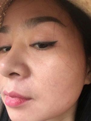 Serium Trị Mụn Nám Essence Peptide