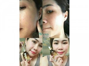 Mỹ phẩm cao cấp hàng quốc Wynn