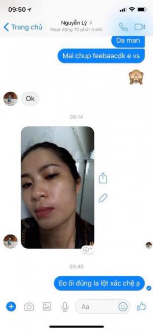 Kem Tichi Nhật giảm mụn, tiêu viêm, làm mờ các vết thâm,