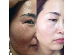 Bộ Dưỡng Da Cao Cấp Collegen Plus Vit E