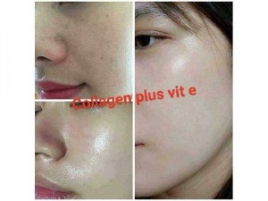 Bộ Dưỡng Da Cao Cấp Collegen Plus Vit E