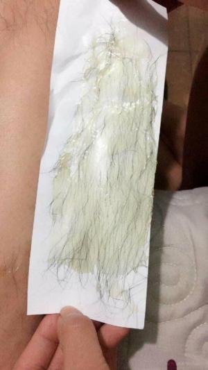 combo triệt lông vĩnh viễn