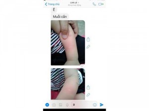 Tinh Dầu Tràm Nguyên Chất