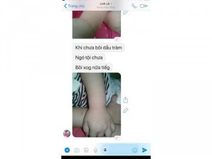 Tinh Dầu Tràm Nguyên Chất