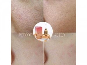 Serum dưỡng trắng 3in 1 Princess White