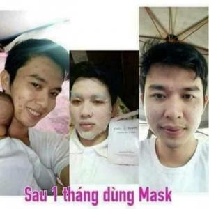 Khách hàng đã sử dụng mặt nạ nhau thai cừu và rất ưng ý với giá trị mà sp mang lại