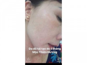 Mỹ phẩm trị nám
