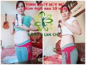 Sản phẩm tiêu mỡ thừa giúp cân bằng cơ thể,làm giảm mỡ lấy lại tự tin sắc đẹp.
