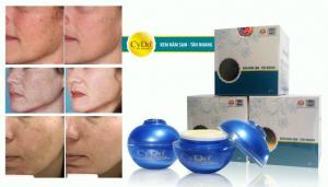 Kem nám sạm tàn nhang cao cấp luxury Cydo 16gr