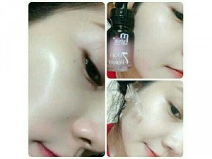Serum 7 day M'White