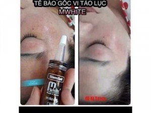 Tế Bào Góc Vi Tảo Lục Nhật Bản đã có mặt tại Việt Nam