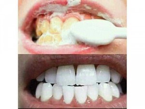 Bột trắng răng t white