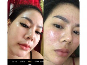 Kem Pháp LANCOMAI SỈ mỹ phẩm kem dưỡng da mặt, dưỡng ẩm trị mụn
