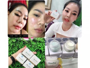 Kem Pháp Sham Sely vua trị nám tàn nhang dưỡng trắng da mặt